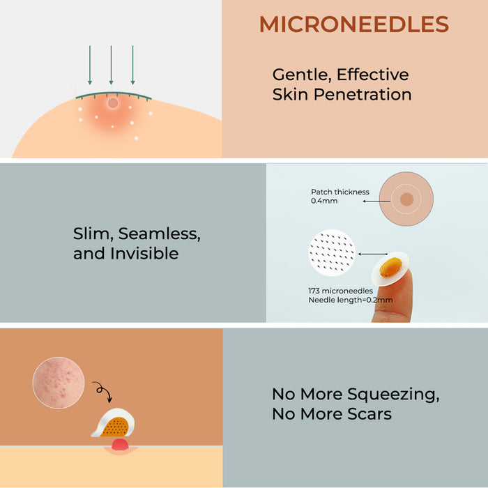 bbold Dissolvable Microneedle Acne Patch